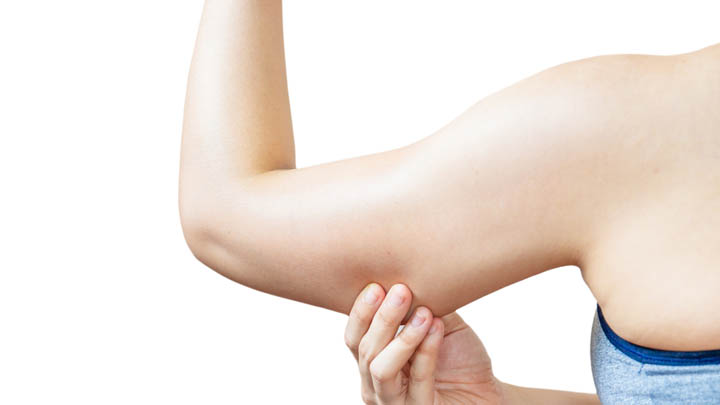 How You Can Forget Flabby Arms Forever