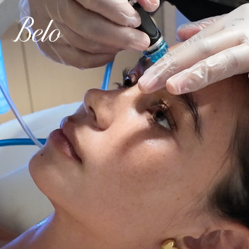 Belo Hydrafacial Treatment