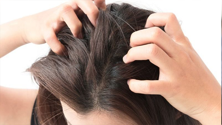 Everything you need to know about scalp acne  Be Beautiful India