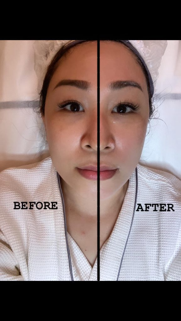 agoo before and after skin reboot