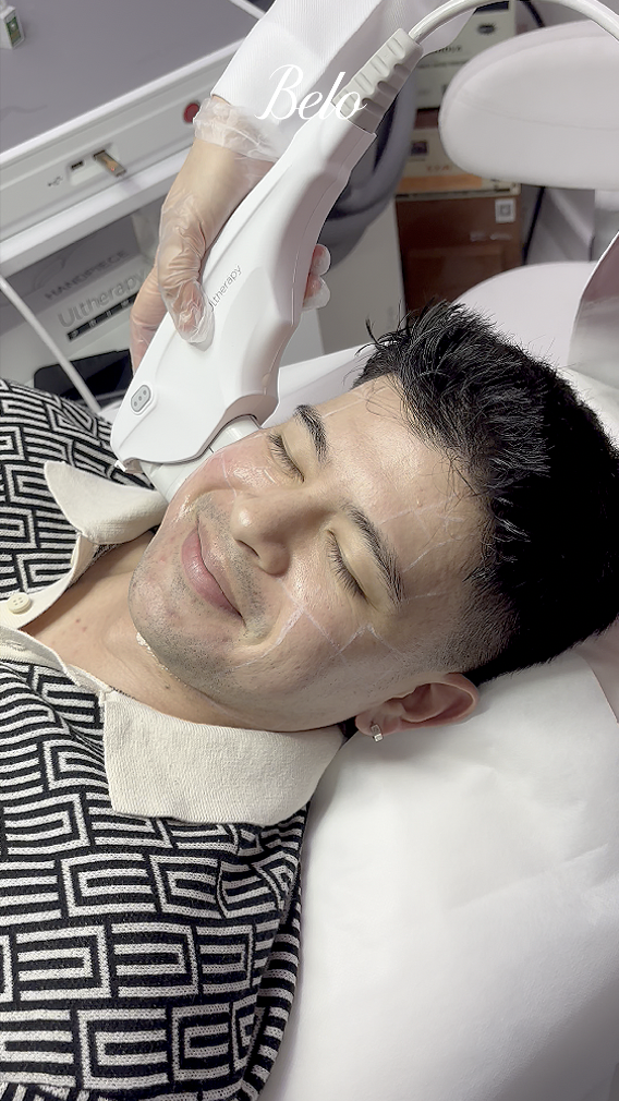 Rayver Cruz does Belo Ulthera Prime