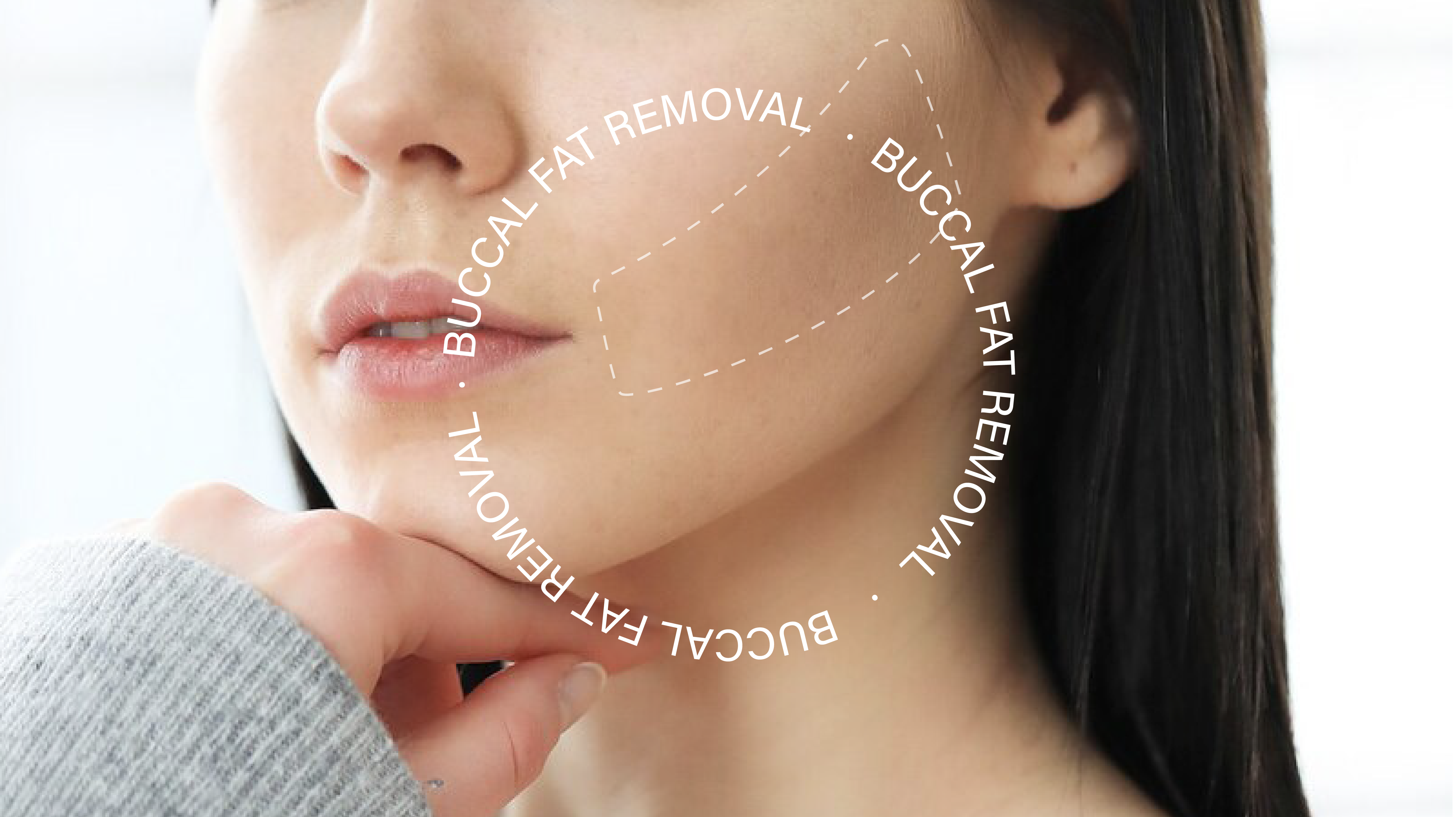 Is Buccal Fat Removal Safe?