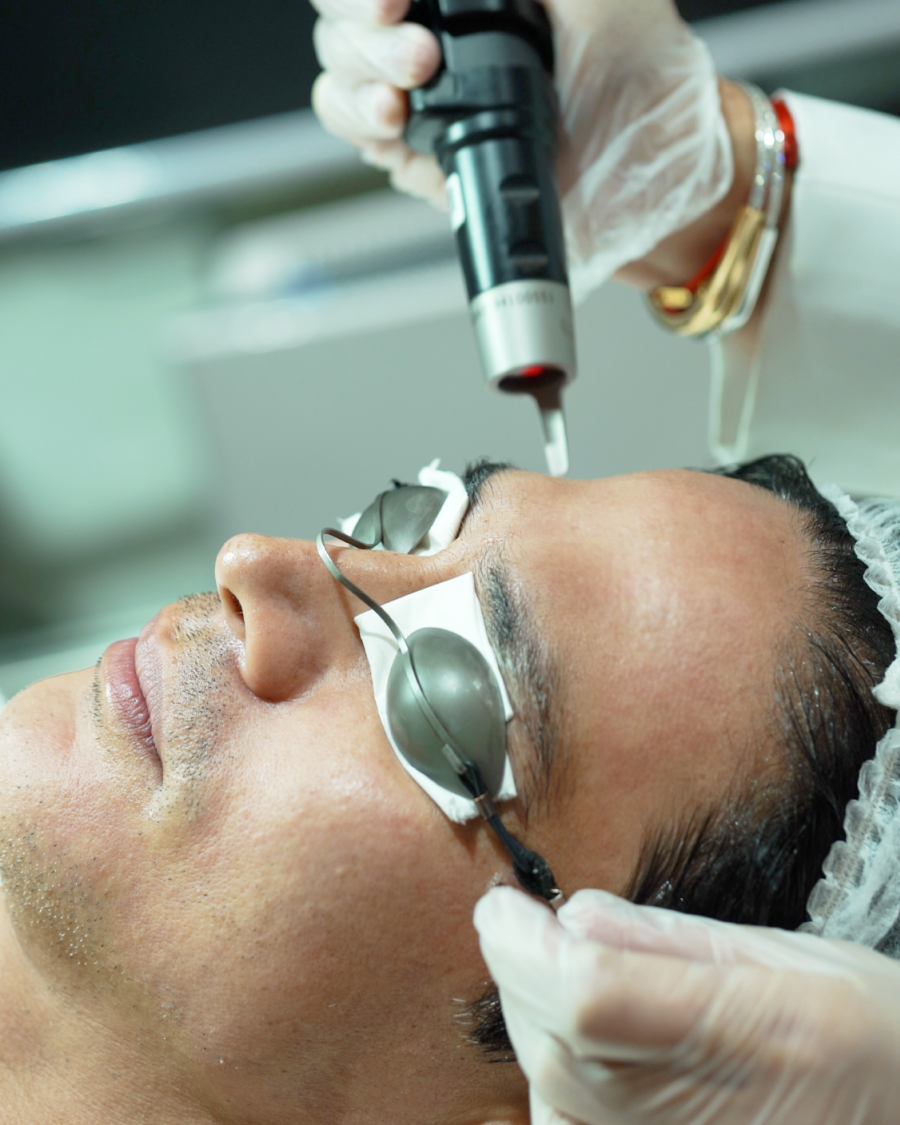 Picosure Pro Laser Treatment in Philippines | Belo Medical
