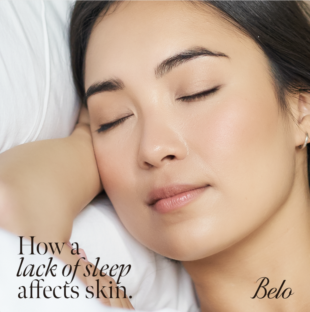 How Lack of Sleep Affects your Skin