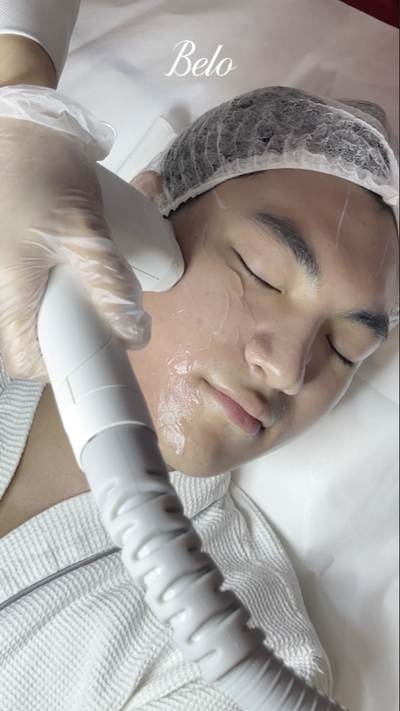 Darren Espanto with the Sofwave Treatment