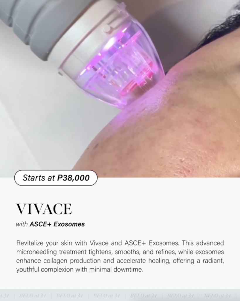  Belo ASCE+ Exosomes pair with Vivace