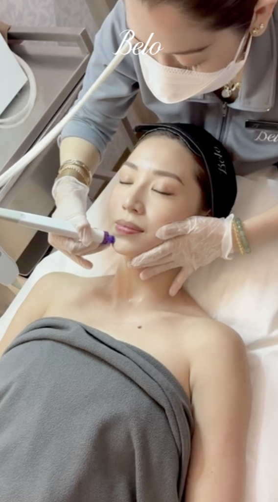 Belo Q-Facial Treatment Kryz Uy