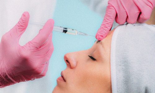 5 Things You Didn’t Know About Dermal Fillers