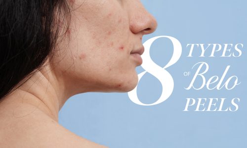 8-types-of-peels