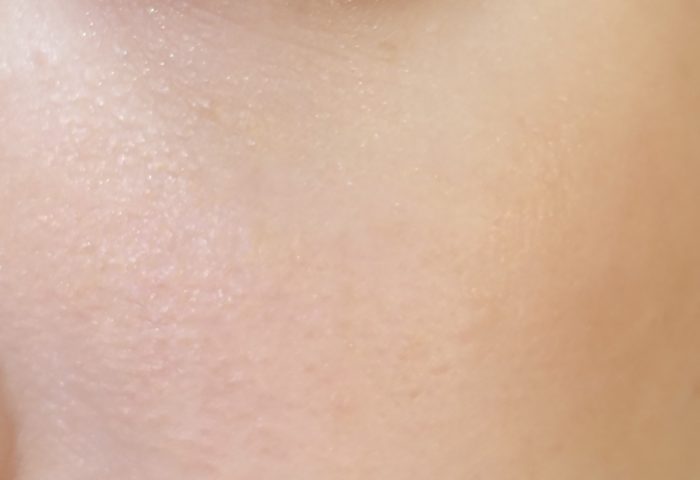 Belo Invisipore - After