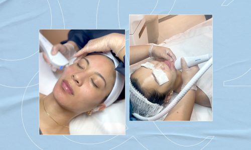 Blog-Tornado-Pore-Cleansing-Facial