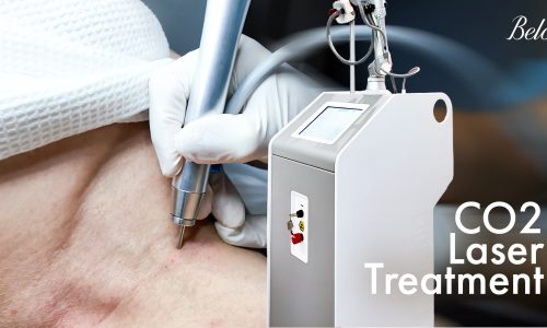 CO2_Laser_Treatment_in_the_Philippines_Benefits_+_What_to_Expect