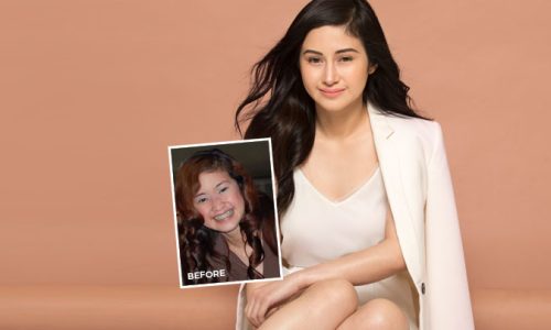 Cheryl Prudente Belo Transformation