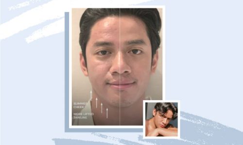 David Guison skin genius