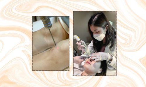 How-To-Lighten-Skin