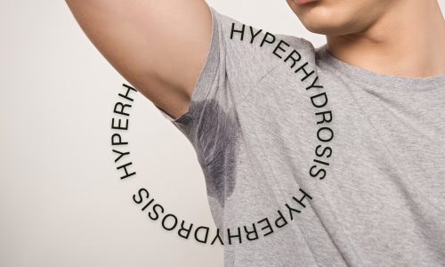 Hyperhidrosis