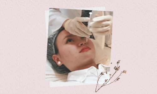 Nicole Tajanlangit nose thread lift belo