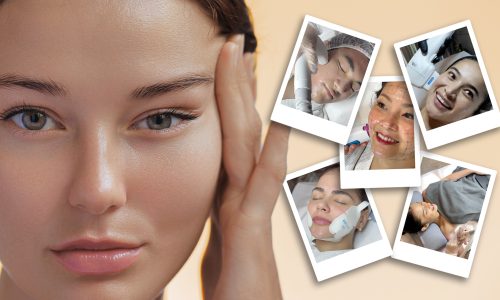 Non-Surgical-Face-Lifts