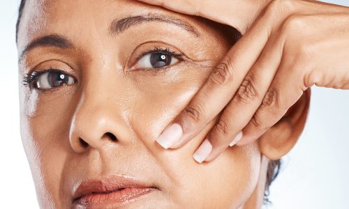 What-Are-Wrinkles,-and-how-do-I-prevent-them-