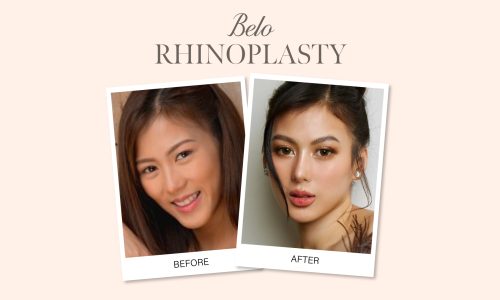 What-to-Know-Before-a-Nose-Job-Redo