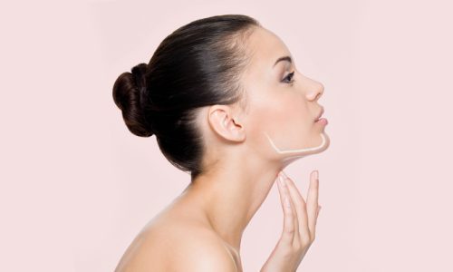 chin and jaw fillers