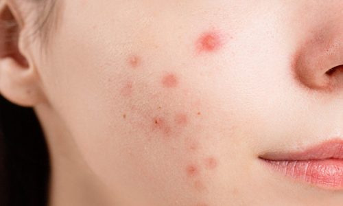 pexels-anna-nekrashevich-6475987